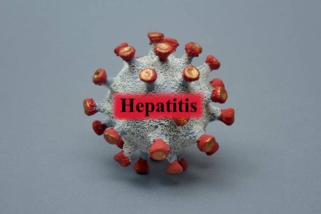 Virusmodell mit Schriftzug Hepatitis Fotomontage: Virusmodell mit Schriftzug Hepatitis, 17.12.2025, Borkwalde, Brandenburg, In ein Virusmodell wurde der Schriftzug Hepatitis montiert. *** Virus model with hepatitis lettering Photomontage Virus model with hepatitis lettering, 17 12 2025, Borkwalde, Brandenburg, Hepatitis lettering was mounted on a virus model