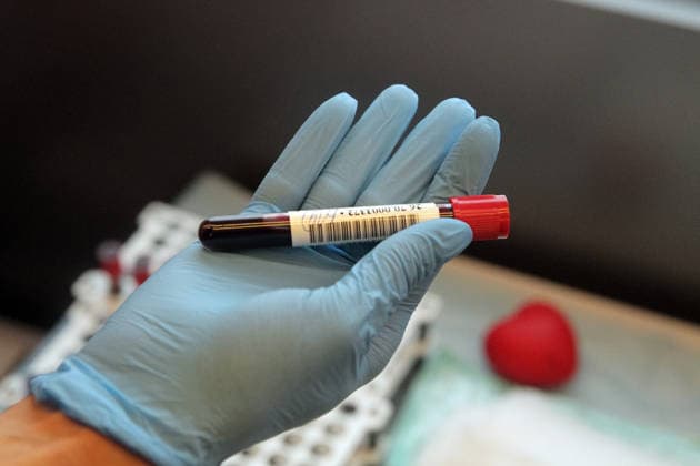Open blood donation held at Kyiv mobile donor hub A medical worker demonstrates a test tube with blood during an open blood donation campaign at the Teplokrovni mobile donor hub outside the Desnianskyi District State Administration building in Kyiv, Ukraine, on January 23, 2026, Credit:Hennadii Minchenko Avalon Ukraine, Kyiv  Copyright: xHennadiixMinchenkox xAvalonx 1069577993