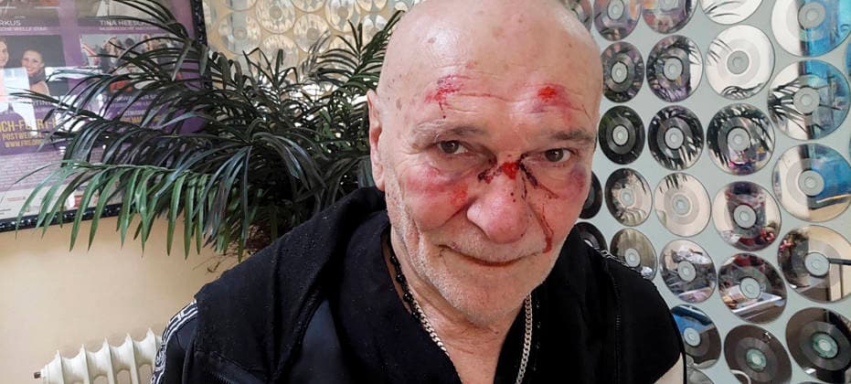 Bild darf mit erlaubnis von Peter Sebastian veroeffentlich werden . Schlagersaenger Peter Sebastian wird in seinem Buero Ueberfallen mit Messer bedroht und geschlagen schwere Gesichts verletzungen. Der Täter flieht die Kripo ermittelt HH Deutschland