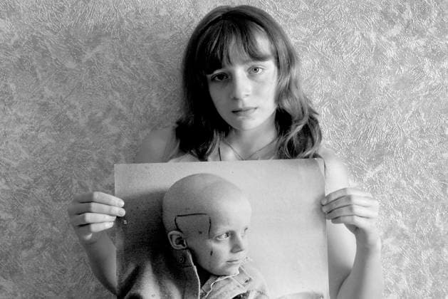 Chernobyl 20 Years After: Kids of Worst Human Made Disaster Katia Alekhno(15 years old) from Bobruisk-Belarus shows the picture of her self shot in 1986 year (when she was 6 )right after Chernobyl disaster when she got sick of leukaemia.Fortunately she survived... Copyright: xPhotoXPressx