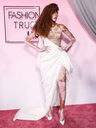 Fashion Trust U.S. Awards 2026 LOS ANGELES, CALIFORNIA, USA - APRIL 07: Winnie Harlow wearing Nicholas Oakwell Couture official arrives at the Fashion Trust U.S. Awards 2026 In Partnership With Google held at nya studios WEST on April 7, 2026 in Los Angeles, California, United States., Credit:Chad Salvador Avalon United States, California, Los Angeles, nya studios WEST  Copyright: xChadxSalvadorx xAvalonx 1089982122