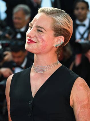 IPA84939009 - Cannes, 79th Cannes Film Festival 2025 - evening 10. Red carpet of La Bola Negra Pictured: Bebe Vio  Copyright: xManuelexMangiarottix xPoolxPhotoxEventsx07x 84939009