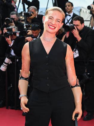 IPA84939006 - Cannes, 79th Cannes Film Festival 2025 - evening 10. Red carpet of La Bola Negra Pictured: Bebe Vio  Copyright: xManuelexMangiarottix xPoolxPhotoxEventsx07x 84939006