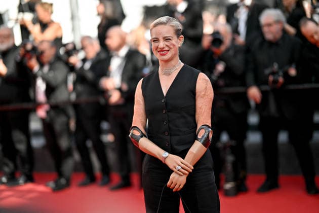 Cannes Screening La Bola Negra JR Bebe Vio attending the screening of the movie La Bola Negra during the 79th Cannes Film Festival in Cannes, France on May 21, 2026. Photo by Julien Reynaud APS-Medias ABACAPRESS.COM Cannes France  Copyright: xReynaudxJulien APS-Medias ABACAx