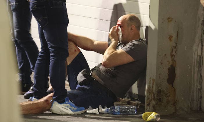 23.05.2026 Belgrade(Serbia) Politika Zivot Politics Life Anti-government protest rally led by Serbia s protesting university students.Injured and bloody man