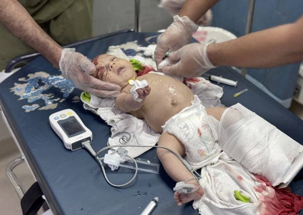 News Bilder des Tages Israeli attacks on Gaza continue despite ceasefire agreement KHAN YUNIS, GAZAI PALESTINE - MAY 25: (EDITOR S NOTE: Image depicts graphic content) A Palestinian baby is taken to Nasser Hospital for medical treatment following the Israeli attack on tents housing displaced people in the al-Mawasi area despite the ceasefire agreement in Khan Yunis, Gaza, Palestine on May 25, 2026. A six-year-old child and a woman were killed and 20 people, most of them children and women, were injured in an attack. Abdallah F.s. Alattar Anadolu Khan Yunis Gaza. Editorial use only. Please get in touch for any other usage.  Copyright: x2026xAnadoluxAbdallahxF.s.xAlattarx