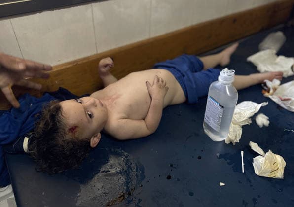 Israeli attacks on Gaza continue despite ceasefire agreement KHAN YUNIS, GAZAI PALESTINE - MAY 25: Palestinian children are taken to Nasser Hospital for medical treatment following the Israeli attack on tents housing displaced people in the al-Mawasi area despite the ceasefire agreement in Khan Yunis, Gaza, Palestine on May 25, 2026. A six-year-old child and a woman were killed and 20 people, most of them children and women, were injured in an attack. Abdallah F.s. Alattar Anadolu Khan Yunis Gaza. Editorial use only. Please get in touch for any other usage.  Copyright: x2026xAnadoluxAbdallahxF.s.xAlattarx