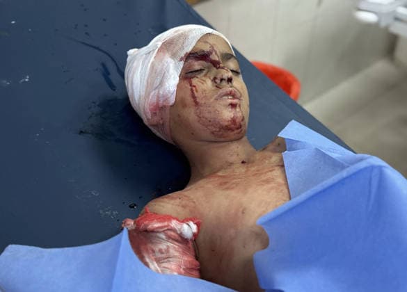 Israeli attacks on Gaza continue despite ceasefire agreement KHAN YUNIS, GAZAI PALESTINE - MAY 25: (EDITOR S NOTE: Image depicts graphic content) Palestinian children are taken to Nasser Hospital for medical treatment following the Israeli attack on tents housing displaced people in the al-Mawasi area despite the ceasefire agreement in Khan Yunis, Gaza, Palestine on May 25, 2026. A six-year-old child and a woman were killed and 20 people, most of them children and women, were injured in an attack. Abdallah F.s. Alattar Anadolu Khan Yunis Gaza. Editorial use only. Please get in touch for any other usage.  Copyright: x2026xAnadoluxAbdallahxF.s.xAlattarx