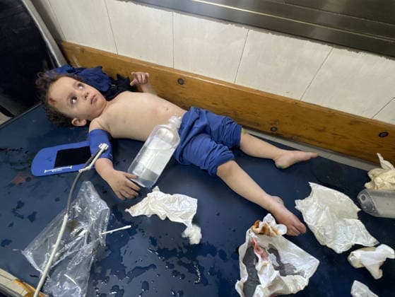 Israeli attacks on Gaza continue despite ceasefire agreement KHAN YUNIS, GAZAI PALESTINE - MAY 25: (EDITOR S NOTE: Image depicts graphic content) Palestinian children are taken to Nasser Hospital for medical treatment following the Israeli attack on tents housing displaced people in the al-Mawasi area despite the ceasefire agreement in Khan Yunis, Gaza, Palestine on May 25, 2026. A six-year-old child and a woman were killed and 20 people, most of them children and women, were injured in an attack. Abdallah F.s. Alattar Anadolu Khan Yunis Gaza. Editorial use only. Please get in touch for any other usage.  Copyright: x2026xAnadoluxAbdallahxF.s.xAlattarx