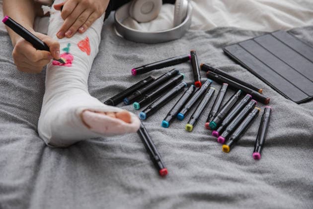 Frau malt auf gebrochenem Bein mit Gipsverband. Unbekanntes Mädchen malt mit Filzstiften auf orthopädischem Gipsverband. Gelangweilte Mädchen mit gebrochenem Bein spielt zu Hause während der Rehabilitation. Behandlung einer Unfallverletzung mit Knochenbru Woman hands drawing on broken leg cast. Unrecognizable girl draws with felt tip pens on orthopedic cast. Bored girl with broken leg playing at home during rehabilitation. Accident injury fracture treatment (License=RF) ,model released, Symbolfoto Copyright: xZoonar.com IuliiaxZavalishinax 25108119 ,model released, Symbolfoto ,property released