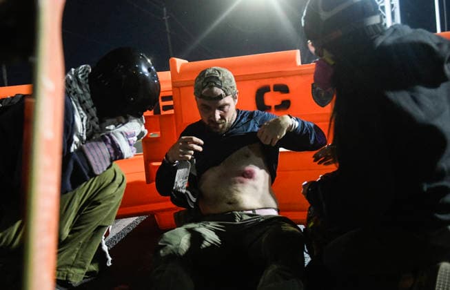 June 1, 2026, Newark, New Jersey, United States: A protester displays injuries received during the clashes with riot police outside Delaney Hall during a protest. Protests continue to be held daily as detainees at Delaney Hall maintain a hunger and labor strike against current conditions at the facility. Newark United States - ZUMAs197 20260601_aaa_s197_252 Copyright: xMatthewxHatcherx
