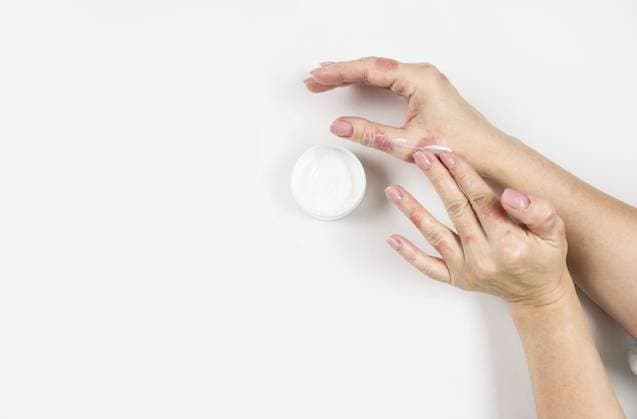 Eine Frau trägt Creme auf ihre Hände auf, um Dermatitis zu behandeln. Hautkrankheiten. Nahaufnahme. Flach liegend A woman applies cream to her hands to treat dermatitis. Skin diseases. Close-up. Flat lay Copyright: imageBROKER ElenaxGrishina ibxiqx17864704.jpg