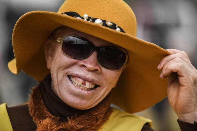 International Albinism Awareness Day in Kenya THIKA, KENYA - JUNE 13: People with albinism take part in activities marking International Albinism Awareness Day, advocating for equal participation in society and raising awareness about the challenges they face across Africa, including discrimination, exclusion and violent attacks, on June 13, 2026, in Thika, Kenya. The annual observance, led by the United Nations, aims to combat prejudice surrounding albinism, protect fundamental human rights and highlight global efforts to end violence against people with albinism. Gerald Anderson Anadolu Thika Kenya. Editorial use only. Please get in touch for any other usage.  Copyright: x2026xAnadoluxGeraldxAndersonx