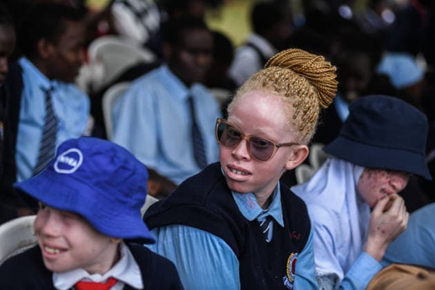 International Albinism Awareness Day in Kenya THIKA, KENYA - JUNE 13: People with albinism take part in activities marking International Albinism Awareness Day, advocating for equal participation in society and raising awareness about the challenges they face across Africa, including discrimination, exclusion and violent attacks, on June 13, 2026, in Thika, Kenya. The annual observance, led by the United Nations, aims to combat prejudice surrounding albinism, protect fundamental human rights and highlight global efforts to end violence against people with albinism. Gerald Anderson Anadolu Thika Kenya. Editorial use only. Please get in touch for any other usage.  Copyright: x2026xAnadoluxGeraldxAndersonx