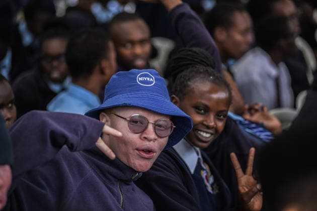 International Albinism Awareness Day in Kenya THIKA, KENYA - JUNE 13: People with albinism take part in activities marking International Albinism Awareness Day, advocating for equal participation in society and raising awareness about the challenges they face across Africa, including discrimination, exclusion and violent attacks, on June 13, 2026, in Thika, Kenya. The annual observance, led by the United Nations, aims to combat prejudice surrounding albinism, protect fundamental human rights and highlight global efforts to end violence against people with albinism. Gerald Anderson Anadolu Thika Kenya. Editorial use only. Please get in touch for any other usage.  Copyright: x2026xAnadoluxGeraldxAndersonx