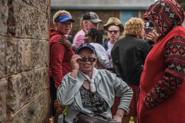 International Albinism Awareness Day in Kenya THIKA, KENYA - JUNE 13: People with albinism take part in activities marking International Albinism Awareness Day, advocating for equal participation in society and raising awareness about the challenges they face across Africa, including discrimination, exclusion and violent attacks, on June 13, 2026, in Thika, Kenya. The annual observance, led by the United Nations, aims to combat prejudice surrounding albinism, protect fundamental human rights and highlight global efforts to end violence against people with albinism. Gerald Anderson Anadolu Thika Kenya. Editorial use only. Please get in touch for any other usage.  Copyright: x2026xAnadoluxGeraldxAndersonx