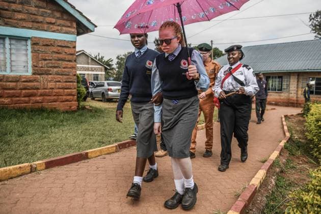International Albinism Awareness Day in Kenya THIKA, KENYA - JUNE 13: People with albinism take part in activities marking International Albinism Awareness Day, advocating for equal participation in society and raising awareness about the challenges they face across Africa, including discrimination, exclusion and violent attacks, on June 13, 2026, in Thika, Kenya. The annual observance, led by the United Nations, aims to combat prejudice surrounding albinism, protect fundamental human rights and highlight global efforts to end violence against people with albinism. Gerald Anderson Anadolu Thika Kenya. Editorial use only. Please get in touch for any other usage.  Copyright: x2026xAnadoluxGeraldxAndersonx