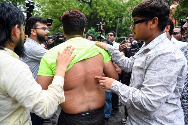 A man shows marks on his back after security personnel use lathis for crowd control as protesters gathered for CJP s protest march New Delhi, Jul 20 (ANI): A man shows marks on his back after security personnel use lathis for crowd control as protesters gathered for CJP s protest march clashed with RPF personnel at Jantar Mantar, in New Delhi on Monday. New Delhi Delhi India Copyright: xANIx ANI_20260720084