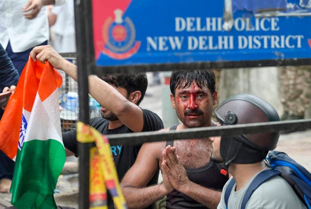NEW DELHI, INDIA - JULY 20: An injured Cockroach Janata Party (CJP) supporter during a protest march, at Sansad Marg on July 20, 2026 in New Delhi, India. (Photo by Raj K Raj Hindustan Times) Delhi Police And Protestors Injured In Clash During Protest March