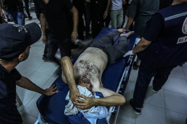 Israel continues its attacks on Gaza despite the ceasefire KHAN YUNIS, GAZA, PALESTINE - JULY 23: Injured Palestinians, including children, are brought to Nasser Hospital for medical treatment after the Israeli army s attack on tents housing displaced civilians despite the ceasefire in Khan Yunis, Gaza, Palestine on July 23, 2026. Abed Rahim Khatib Anadolu Khan Yunis Gaza. Editorial use only. Please get in touch for any other usage.  Copyright: x2026xAnadoluxAbedxRahimxKhatibx