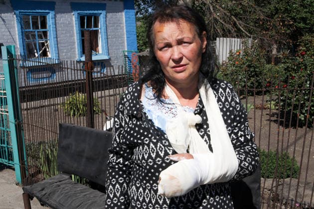 Russia Strikes Home of Large Family Near Kryvyi Rih - Ukraine A woman with a bandaged left arm is pictured after a Russian missile strike on a residential area, Radushne settlement, Kryvyi Rih district, Dnipropetrovsk region, Ukraine, July 30, 2026. On the night of 29?30 July 2026, Russian occupying forces launched an Iskander-M ballistic missile at the settlement, hitting a private house where a large family lived. Six deaths have been officially confirmed: the parents and three of their children were killed. Search and rescue operations are underway, as other children from the family may remain trapped under the rubble. In total, two private houses were destroyed, while the blast wave and debris severely damaged at least five neighbouring  Copyright: xMyakshykovxMykola Ukrinform ABACAx