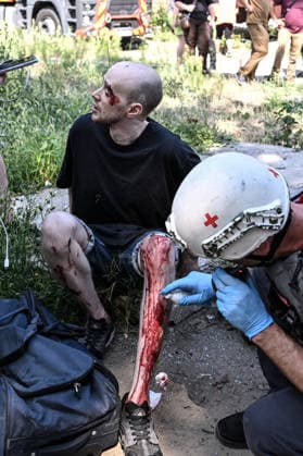 A medic sprays a blood-stained leg of a man injured by a Russian air strike, Zaporizhzhia, Ukraine, August 10, 2026. Russian forces attacked civilian infrastructure in the regional capital and the Zaporizhzhia district with guided aerial bombs. Apartment blocks and private houses were damaged, and cars were wrecked. At least 24 people were injured, including two children. (Photo by Dmytro Smolienko Ukrinform) Russian army attacks Zaporizhzhia with guided bombs again  Copyright: xDmytroxSmolienkox
