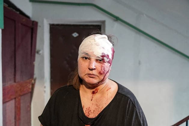 August 18, 2026, Kramatorsk, NULL, Ukraine: A woman with a bandage around her head and blood on her face in the hallway of an apartment building following a Russian strike on Kramatorsk, west of the Donbas region in Ukraine, on the morning of August 18, 2026. Kramatorsk Ukraine - ZUMAa252 20260818_zip_a252_001 Copyright: xDavidxAllignonx