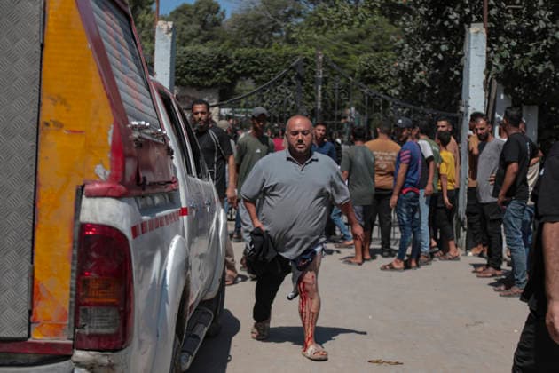 Gaza City Strike Kills Palestinians An injured Palestinian man with blood on his lower leg walks beside an emergency vehicle after an Israeli strike near the municipal park in central Gaza City, the Gaza Strip, on August 19, 2026. At least nine Palestinians were killed and more than 15 others were wounded in the strike, including women and children, according to an initial toll. The strike came shortly after another Israeli attack targeted the municipal police command headquarters in Gaza City. Gaza Gaza Strip Palestinian Territories Copyright: xEyadxAzamx
