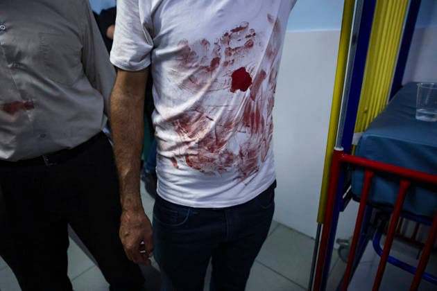 Farewell for 17 Year Old Karim Al Shalaldeh Blood stains the white shirt of a Palestinian mourner during the funeral of 17-year-old Karim Sanad Shalaldeh in Sa ir, northeast of Hebron, in the occupied West Bank, on August 21, 2026. The Palestinian Health Ministry said Shalaldeh was killed by Israeli settler gunfire during an attack in the Khirbet Hamroush area of Sa ir that also wounded a 70-year-old Palestinian man; local reports said settlers set fire to a home, while the Israeli military said a security official opened fire after Palestinians threw stones at Israelis who were in the area without prior authorization. Hebron West Bank Palestinian Territories Copyright: xMosabxShawerx