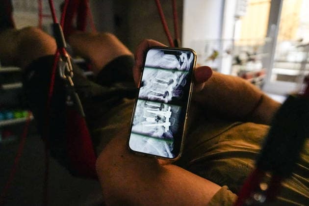 News Bilder des Tages August 25, 2026, Chernihiv, Chernihiv Oblast, Ukraine: A military man undergoing rehabilitation shows X-rays of his spine at a military hospital in Chernihiv, north of Kyiv, Ukraine, on August 25, 2026. Chernihiv Ukraine  - ZUMAa252 20260825_zip_a252_001 Copyright: xDavidxAllignonx