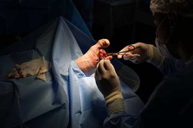 August 25, 2026, Chernihiv, Chernihiv Oblast, Ukraine: WARNING: Graphic content. A surgeon performs a surgery on the foot of a military man at a military hospital in Chernihiv, north of Kyiv, Ukraine, on August 25, 2026. Chernihiv Ukraine  - ZUMAa252 20260825_zip_a252_006 Copyright: xDavidxAllignonx