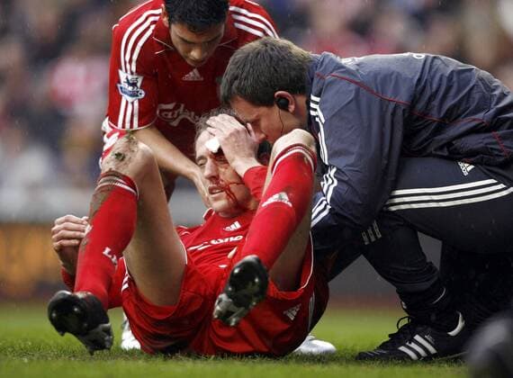 Peter Crouch (Liverpool) sitzt mit einer blutenden Kopfwunde am Boden und wird behandelt - EDITORIAL USE ONLY. No use with unauthorised audio, video, data, fixture lists, club league logos or live services. Online in-match use limited to 120 images, no video emulation. No use in betting, games or single club league player publications. Fußball Herren English Premier League 2006 2007, 1. Englische Liga, FC Liverpool Gruppe Liverpool Fußball Herren English Premier League 2006 2007, 1. Englische Liga, FC Liverpool Gruppe Liverpool