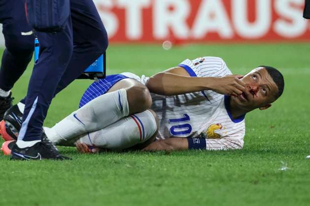 Kylian Mbappe (Frankreich, 10) am Boden , Fussball, UEFA , Europa Meisterschaft, (Gruppe D) 2024, Oesterreich vs. Frankreich, 17.06.2024, Duesseldorf Arena, Duesseldorf, Deutschland Duesseldorf Duesseldorf Arena Nordrhein-Westfalen Deutschland Copyright: xGrantxHubbsx