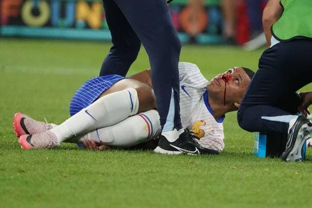 EURO 2024, Fussball, UEFA EURO, EM, Europameisterschaft,Fussball 2024, EM 2024, Gruppenphase, Gruppe D, Österreich-Frankreich, Düsseldorf Arena Düsseldorf, kylian mbappe Frankreich, Nase verletzt, Blutet