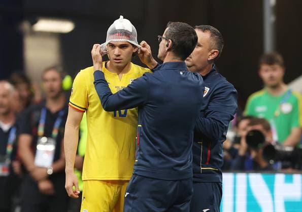 Ianis Hagi of Romania receives treatment for a head injury Romania v Netherlands, UEFA European Championship, EM, Europameisterschaft 2024, Round of 16, Football, Munich Football Arena, Munich, Germany - 02 Jul 2024 EDITORIAL USE ONLY No use with unauthorised audio, video, data, fixture lists, club league logos or live services. Online in-match use limited to 120 images, no video emulation. No use in betting, games or single club league player publications. Copyright: xPaulxCurrie Shutterstockx 14566647ao
