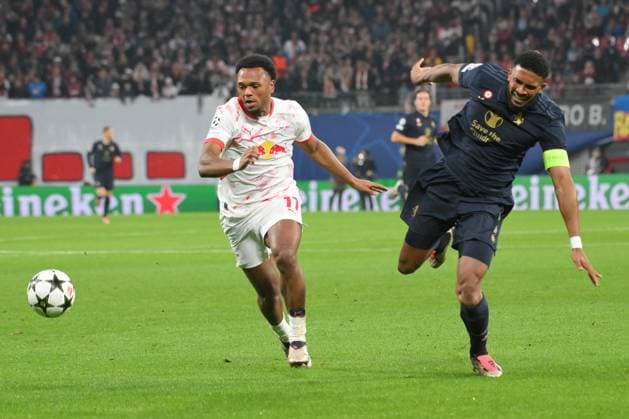Zweikampf zwischen Lois Openda (RB Leipzig) li. und Bremer (Juventus Turin) re., der danach verletzt ausgewechselt wird. GER, RB Leipzig vs. Juventus Turin, Fussball, UEFA Champions League, 2. Spieltag, Saison 2024 2025, 02.10.2024 DFB DFL REGULATIONS PROHIBIT ANY USE OF PHOTOGRAPHS AS IMAGE SEQUENCES AND OR QUASI-VIDEO GER, RB Leipzig vs. Juventus Turin, Fussball, UEFA Champions League, 2. Spieltag, Saison 2024 2025, 02.10.2024 Leipzig Copyright: xEibner-Pressefoto BertxHarzerx EP_BHR