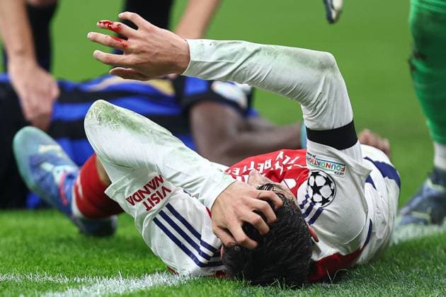 Sport Bilder des Tages Kai Havertz of Arsenal sustains a bloody head injury Inter Milan v Arsenal, UEFA Champions League, Group Stage, Football, San Siro Stadium, Milan, Italy - 06 Nov 2024 EDITORIAL USE ONLY No use with unauthorised audio, video, data, fixture lists, club league logos or live services. Online in-match use limited to 120 images, no video emulation. No use in betting, games or single club league player publications. Copyright: xMarcoxCanienero Shutterstockx 14863816bf
