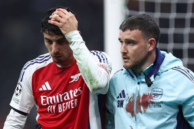 Kai Havertz of Arsenal sustains a bloody head injury Inter Milan v Arsenal, UEFA Champions League, Group Stage, Football, San Siro Stadium, Milan, Italy - 06 Nov 2024 EDITORIAL USE ONLY No use with unauthorised audio, video, data, fixture lists, club league logos or live services. Online in-match use limited to 120 images, no video emulation. No use in betting, games or single club league player publications. Copyright: xMarcoxCanienero Shutterstockx 14863816bi