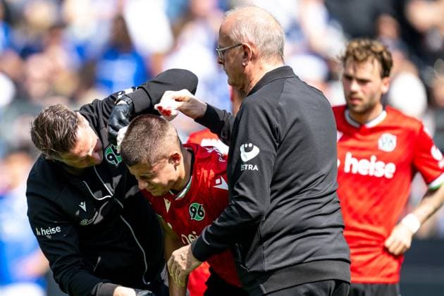 Nicolo Tresoldi (Hannover 96, 09) muss verletzt den Platz verlassen, GER, SV Darmstadt 98 vs. Hannover 96, 2. Bundesliga, Fussball, 30. Spieltag, Saison 2024 2025, 20.04.2025. DFL REGULATIONS PROHIBIT ANY USE OF PHOTOGRAPHS as IMAGE SEQUENCES and or QUASI-VIDEO. GER, SV Darmstadt 98 vs. Hannover 96, 2. Bundesliga, Fussball, 30. Spieltag, Saison 2024 2025, 20.04.2025. Darmstadt