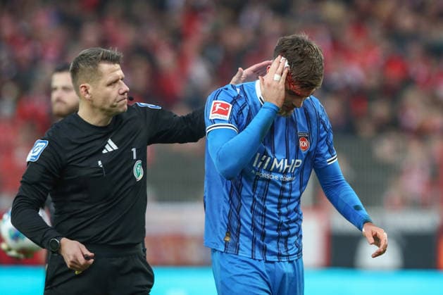29.11.2025, xtgx, Fussball 1. Bundesliga, 1. FC Union Berlin - 1. FC Heidenheim emspor, v.l. Julian Niehues (Heidenheim, 16), Niklas Dorsch (Heidenheim, 30) verletzt, Verletzung, injury, injured, Kopf, Blut, blutet (DFL DFB REGULATIONS PROHIBIT ANY USE OF PHOTOGRAPHS as IMAGE SEQUENCES and or QUASI-VIDEO) Berlin