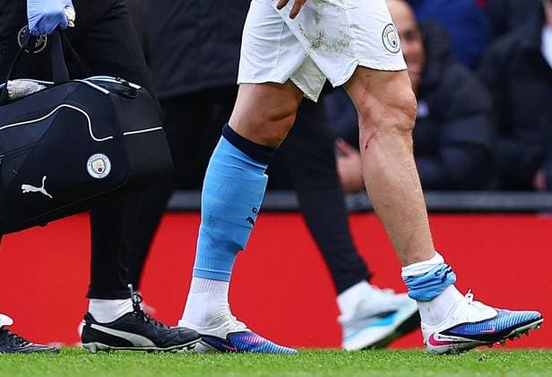 Erling Haaland of Manchester City sports a cut a scratches on their leg Manchester United, ManU v Manchester City, Premier League, Football, Old Trafford, Manchester, UK - 17 Jan 2026Manchester Old Trafford United Kingdom EDITORIAL USE ONLY No use with unauthorised audio, video, data, fixture lists, club league logos or live services. Online in-match use limited to 120 images, no video emulation. No use in betting, games or single club league player publications. Copyright: xMattxWest Shutterstockx 16347907v