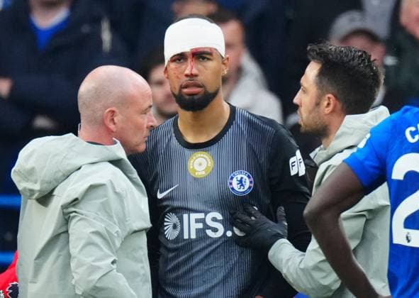 Chelsea goalkeeper Robert Sanchez is forced off injured Chelsea v Nottingham Forest, Premier League, Football, Stamford Bridge, London , UK - 04 May 2026London Stamford Bridge United Kingdom EDITORIAL USE ONLY No use with unauthorised audio, video, data, fixture lists, club league logos or live services. Online in-match use limited to 120 images, no video emulation. No use in betting, games or single club league player publications. Copyright: xJavierxGarcia Shutterstockx 16854610bf