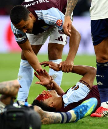 Ollie Watkins of Aston Villa seen with a cut to his head after a clash with Morato of Nottingham Forest. Aston Villa v Nottingham Forest, UEFA Europa League, Semi Final, Second Leg, Football, Villa Park, Birmingham, UK - 07 May 2026Birmingham Villa Park United Kingdom EDITORIAL USE ONLY No use with unauthorised audio, video, data, fixture lists, club league logos or live services. Online in-match use limited to 120 images, no video emulation. No use in betting, games or single club league player publications. Copyright: xJamesxMarsh Shutterstockx 16861510bi