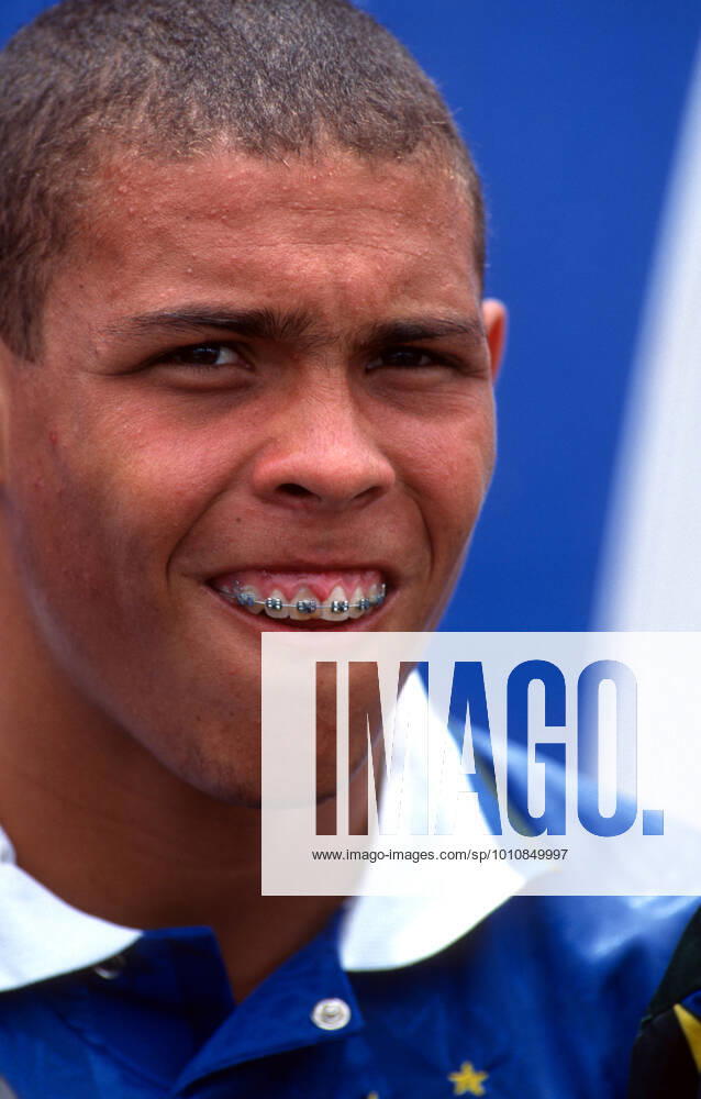 Holland v Brazil 9 July 1994 - FIFA World Cup, WM, Weltmeisterschaft, Fussball USA 1994 - Holland v Brazil - Ronaldo of Brazil shows off his braces - Photo: Mark Leech Offside. Dallas USA