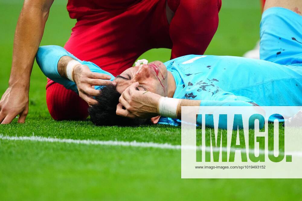 KW47 Mandatory Credit: Photo by Javier Garcia Shutterstock (13626340bm) Alireza Beiranvand of Iran receives treatment for a bloodied nose England v Iran, FIFA World Cup, WM, Weltmeisterschaft, Fussball 2022, Group B, Football, Khalifa International Stadium, Ar-Rayyan, Qatar - 21 Nov 2022 Editorial Use Only England v Iran, FIFA World Cup 2022, Group B, Football, Khalifa International Stadium, Ar-Rayyan, Qatar - 21 Nov 2022 Editorial Use Only
