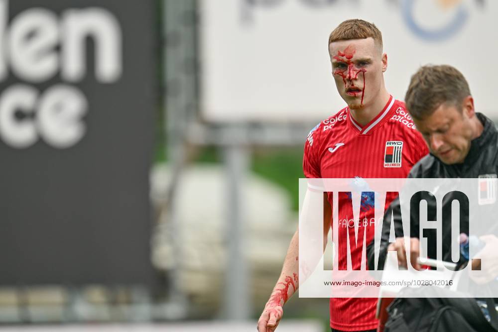 KW15 RWDM s Jake O Brien leaving the pitch with a bleeding nose during a soccer match between RWDM and SK Beveren, Sunday 16 April 2023 in Brussels, on day 7 (out of 10) of the Promotion Play-Offs of the 2022-2023 Challenger Pro League 1B second division of the Belgian championship. DAVIDxCATRY x65017079x