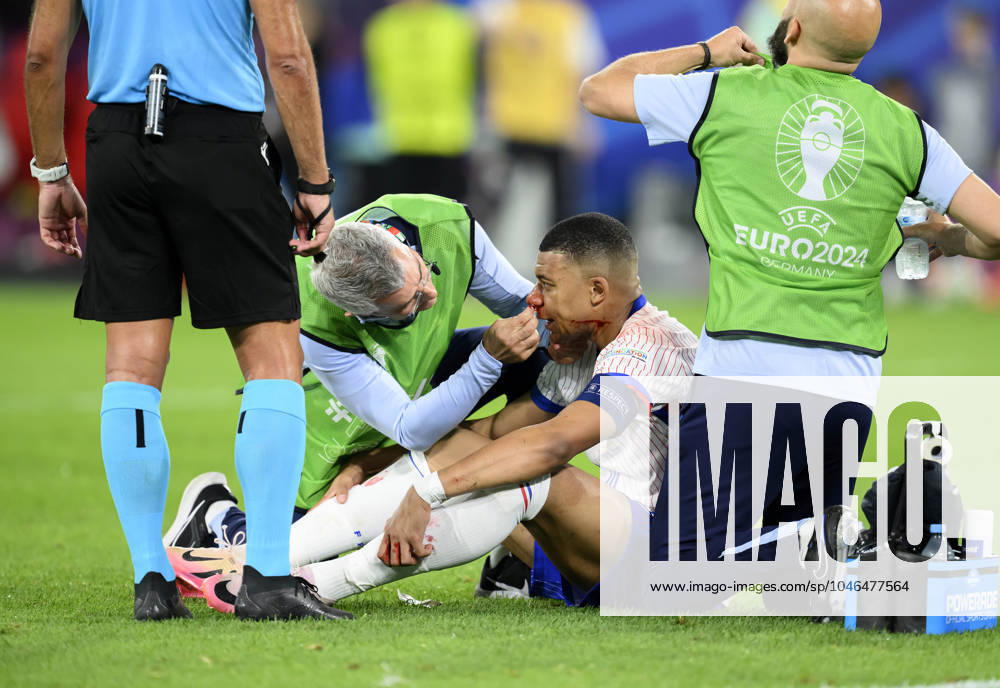 Kylian MBAPPE (FRA) mit blutiger Nase, Blut, Verletzung, Gesicht, Kopf, Nasenbeinbruch, wird behandelt, Verletzung, Vorrunde 1. Spieltag, Gruppe D, Match M08, Oesterreich (AUT) - Frankreich (FRA) 0:1 am 17.06.2024 in Duesseldorf Deutschland. Fussball Europameisterschaft 2024 vom 14.06. - 14.07.2024 in Deutschland. Â