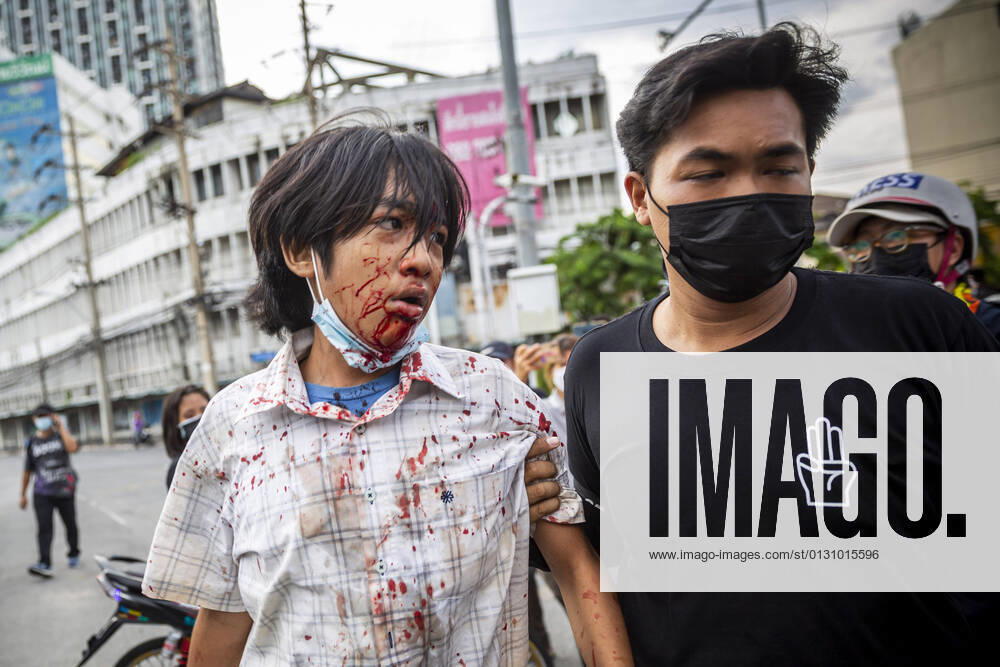 A 15 year old boy is led away to be taken to hospital after being hit in the face with a rubber bullet. For the 8th consecutive night Bangkok s Din Daeng district has been the scene of intense clashes. Informally aligned with the pro democracy protest movement that started in July 2020 vocational student groups have increasingly agitated confrontations with police, frustrated with the dire impact the third wave of Covid -19 has had on Thailand and the governmentâ€⠢s perceived incompetence in handling the crisis these youth see no other option than to resort to violence against the state. Bangkok Thailand - ZUMAt128 20210822_zap_t128_003