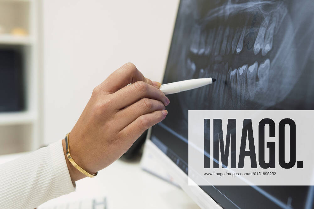 Dentist analyzing teeth X-ray over intraoral scanner screen in clinic model released property released, PNAF03083