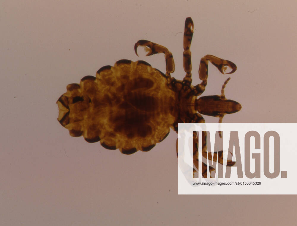 Pork louse as a parasite under the microscope 50x, model released, , property released, , 33434396.jpg, Mundwerkzeuge, Parasiten, Small, antennae, arthropods, claws, compound eyes, creepy-crawlies, insects, lice, macro, magnification, microscopy, mouthparts, parasites, pork louse, sucking, tiny, vermin